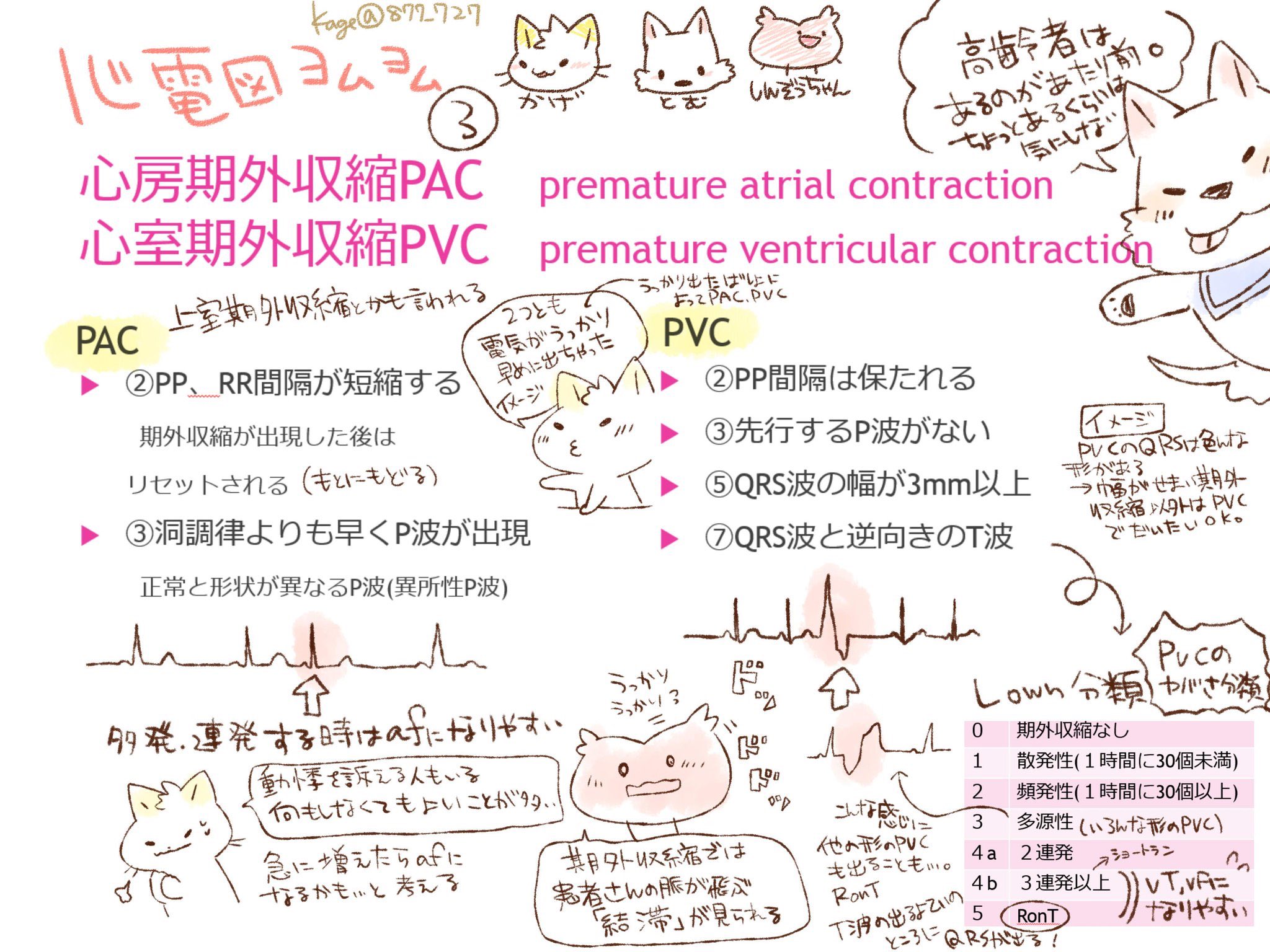 看護師のかげさん イラスト看護帖書籍化 心電図ヨムヨム講座 期外収縮 突然早めにポコッと出たらたいてい期外収縮 ある ないというより 出てる場所や頻度 経過に注目することがポイント 勉強したてはどうしてもvとaがごっちゃになっていたので