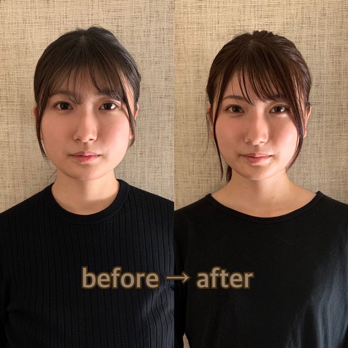 頭蓋骨小顔矯正サロン grace fiore 新宿店 on X: 私が実際に施術してもらった感想✨ 小顔矯正 なのに眠ちゃう😪  終わって目を開けるとすごい目の開きがいいのが分かる😳 骨盤の歪み、エラ張り改善されてきた👍 鼻が整形したみたいに綺麗になった(超音波)  2ヶ月でこれだ ...