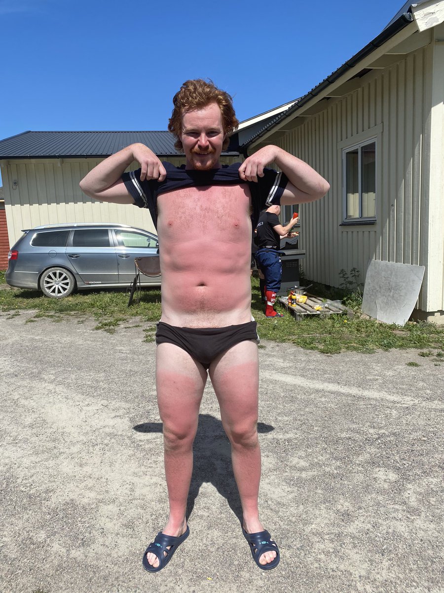 MpaGustafsson's tweet photo. Han missar alltså första ispasset pga att han har för ont för att få på sig utrustningen. Gingers. You can’t make this shit up ☀️😂#svbandy https://t.co/nSMaDr4RLD