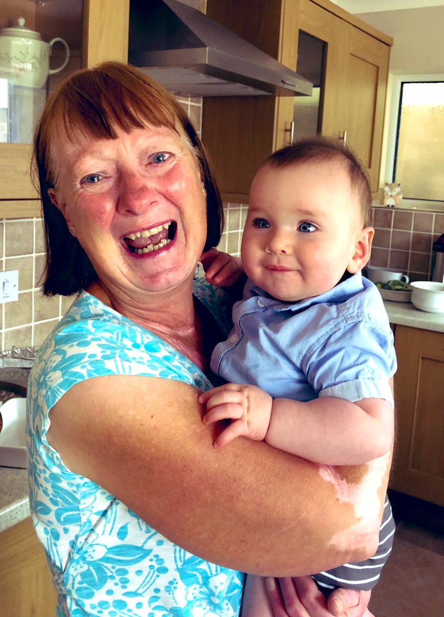 chilean_nat's tweet photo. The joy in the eyes of a Grandma that is able to hold her grandson after 3 months.
#CheersBoris #Bubble #Family #SingleLady #Grandma #Grandson #Joy #Tears #Lockdown #Quarantine #QuarantineLife #Covid19 #Coronavirus https://t.co/teHpXv3clC