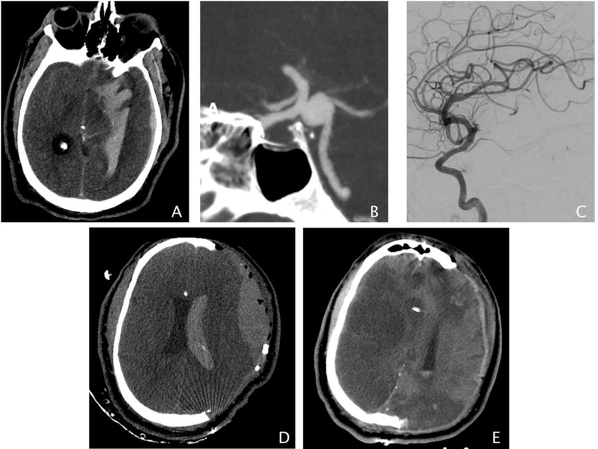 International Journal of Stroke tweet media