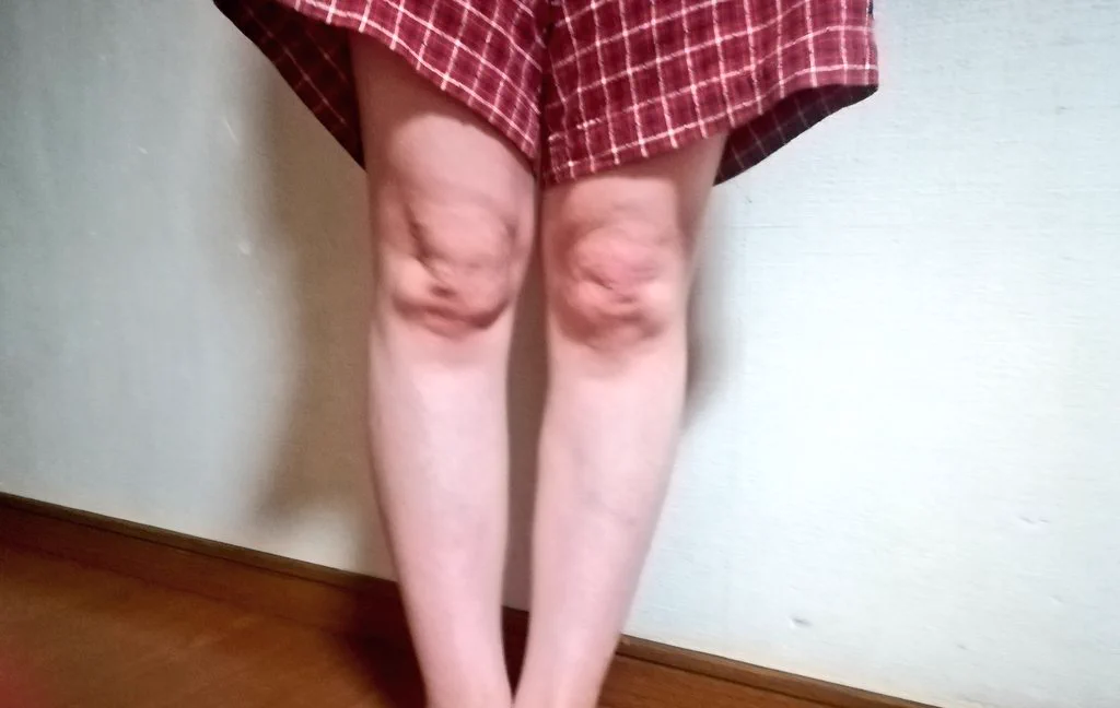 これが本当の膝小僧？！膝に小僧が住んでいると騒がれたほどの膝がこちらです！