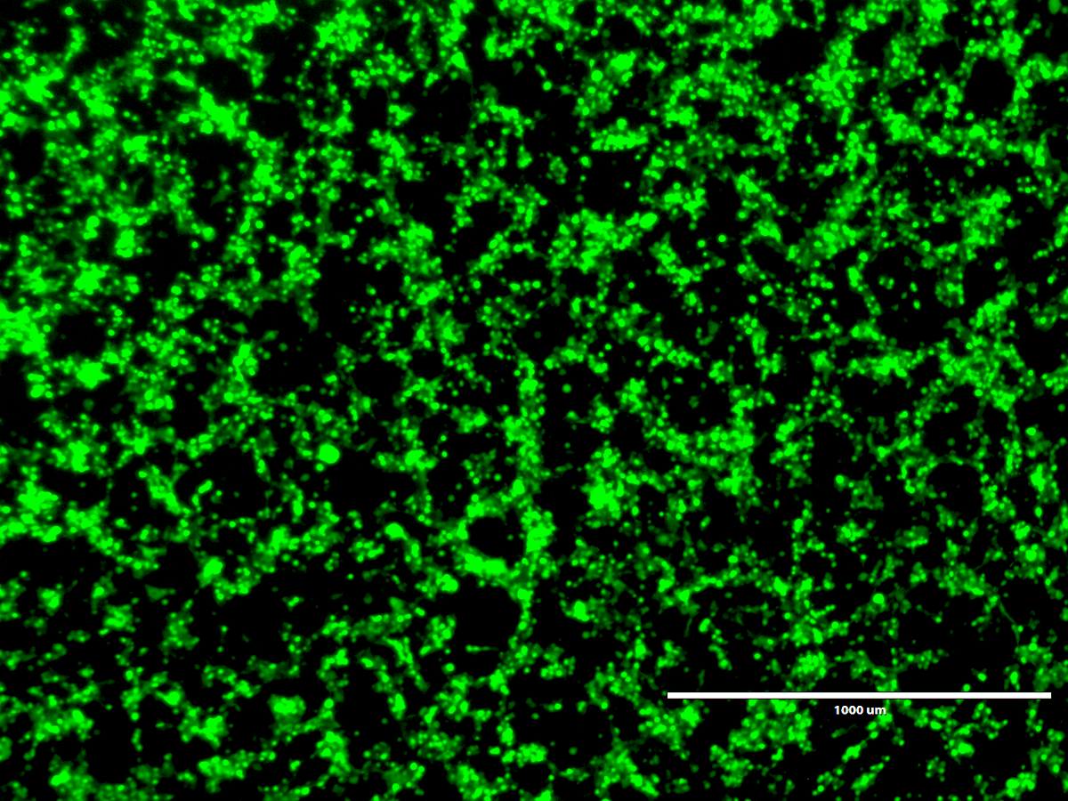 GeneTherapy_SN's tweet photo. A scalable and cost-effective workflow for lentivirus production using a combination of transfection enhancers and PEIMAX optimized in adherent cells at @NUSingapore. Take a look ➡️https://t.co/MQbCA6kPHi
#gttech
📸 :Transfected HEK293TA lentiviral packaging cells https://t.co/aUrTzTZJTh