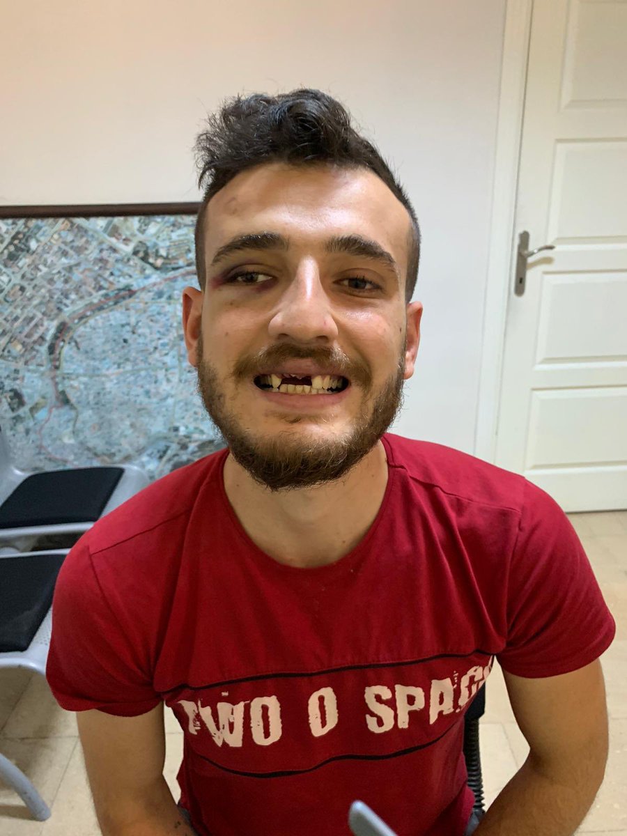 MSTanrikulu's tweet photo. Diyarbakır Çarşı Karakolu'nun karşısında cafe işleten iki esnaf kardeş dün Çarşı Karakolu'nda bu hale getirilmiş
3 diş yok, kafada dikişler ve çok sayıda darp izi. 
Polis her zamanki gibi mukavemet tutanağı tutmuş. 
Yapılanlar çok açık işkence suçudur
@TC_icisleri @DBakirValiligi https://t.co/iWL7HC3e8g