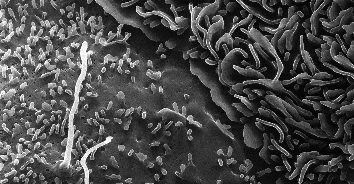browndennis14's tweet photo. Cell heterogeneity in the collecting duct. Principal cell on left (this is a cilium! - with apologies to Crocodile Dundee) and intercalated cell with amazing apical microplicae on right. ICs do not have a cilium. https://t.co/Wv0ln92Njm