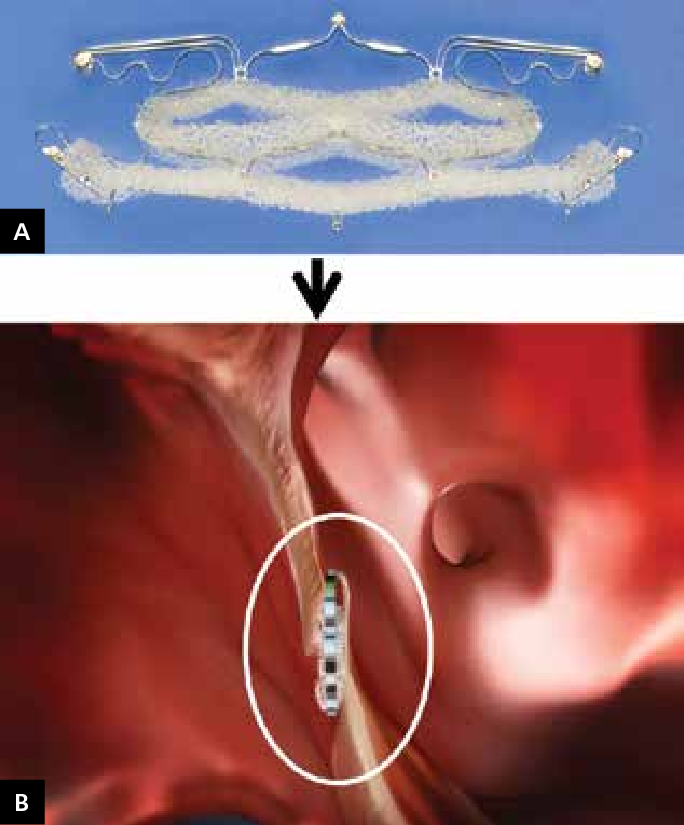hesaitix tweet media