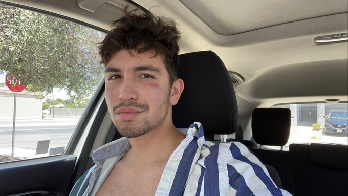 Watch that bitch's leaked NSFW photo on TwXstars