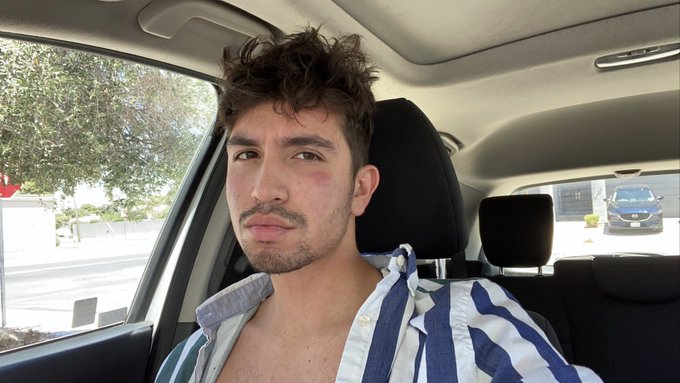 Watch that bitch's leaked NSFW photo on TwXstars