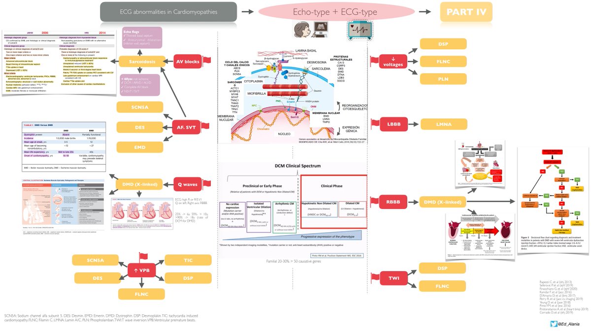 Ed_Alania's tweet photo. 🔴ECG abnormalities in #cardiomyopathies. 🚩Red flags for ECG-type &amp; Echo-type some clues💡
✅HCM
✅DCM
✅ACM
✅RCM
@S2beri  @CSHeartResearch @jodieingles27 @MJAckermanMDPhD @cardionerds @FlavioDascenzi @s_gati @DrMaiteTome @sday_hcm @SPapatheodorou  @DrAneilMalhotra @fazalabul https://t.co/GLPZ0yRIbD