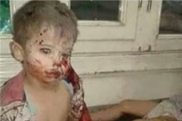 إخجلوا من انفسكم أيها عرب:
قتلوا اطفالنا ودمروا ديارنا وانتم صامتون.
انهم يقتلونا بسلاح التحالف الداعم للارهاب من تحت الطاولة.
6 سنوات ونحن نذبح من الوريد للوريد ابتداءً منذ قتلنا بنيران صديقة في 2015 وحتى اليوم يقتل فيه أطفالنا.
6 سنوات والارهاب يتآمر علينا من فنادق (الرياض)!