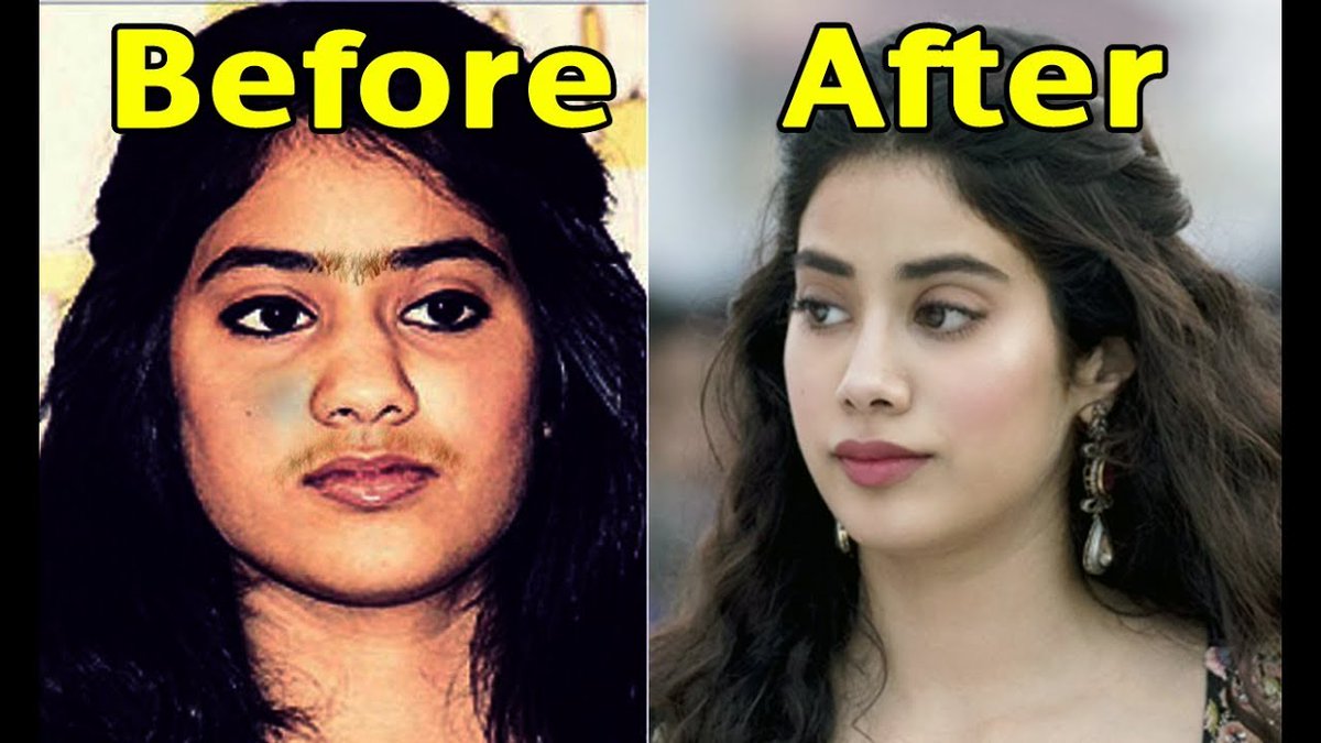 Also did you all see Jhanvi before her surgeries? 