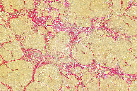 MedUni_Wien's tweet image. Christian-Doppler-Labor für Portale #Hypertension und #Fibrose bei #Lebererkrankungen an der MedUni Wien wird eröffnet.
Die Eröffnung findet heute von 14:00 bis 15:15 Uhr als Online-Event statt. bit.ly/2Yw4W3Y