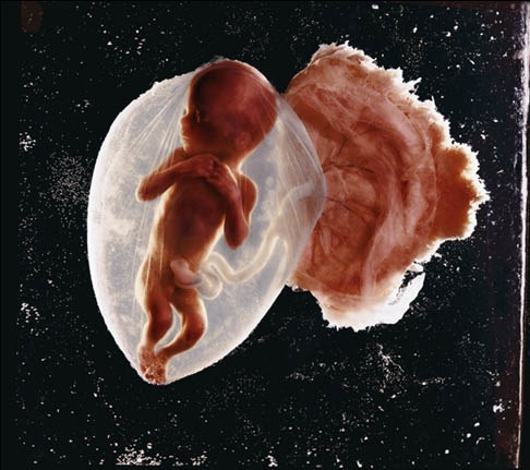 12/"How Life Begins" - one of the first pictures taken with the endoscope, 1965.