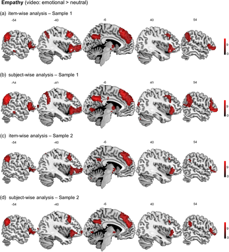 pkanske's tweet photo. Now fully open access, our *fMRI item analysis of empathy and Theory of Mind* with Matthias Tholen @MathisTautwein  Anne Böckler &amp; Tania Singer
@tudresden_de @TUD_Science @KanskeLab @MPI_CBS 
https://t.co/VLxvpjQqwY https://t.co/CxttjnAhcX