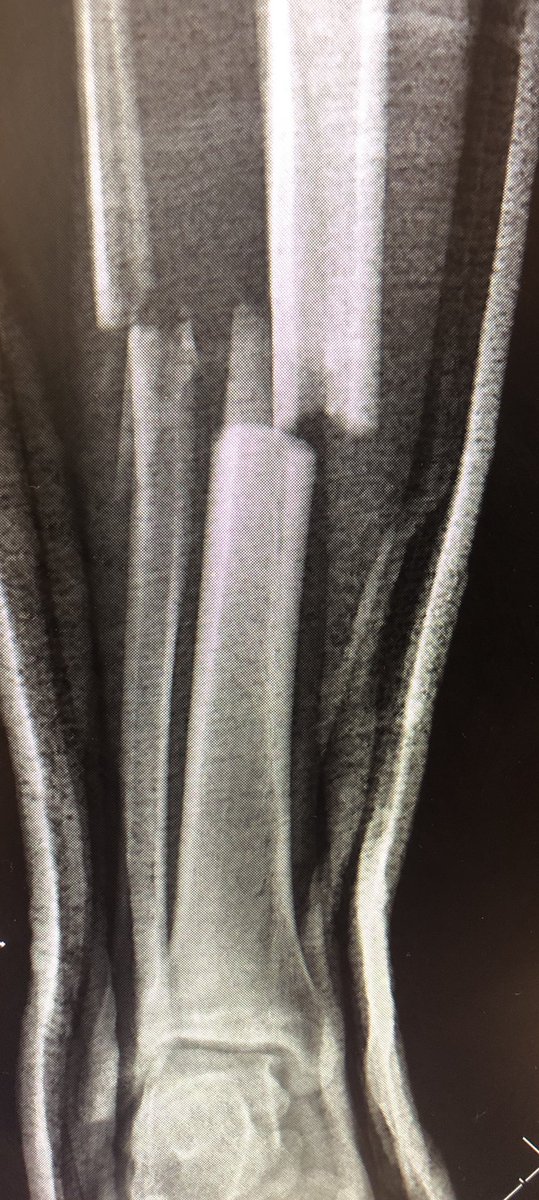 Yelena Bogdan, MD, FACS, FAAOS tweet media