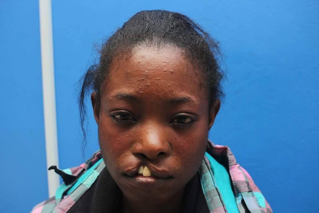 mahmahlet_'s tweet photo. Hi, please if you know anybody found with such abnormalities either Cleft lip or palate, kindly sent me a DM, it’s a free Surgery and free medication too.
Kindly Retweet please.

Thanks as you help save Life. https://t.co/1YN565PoKE