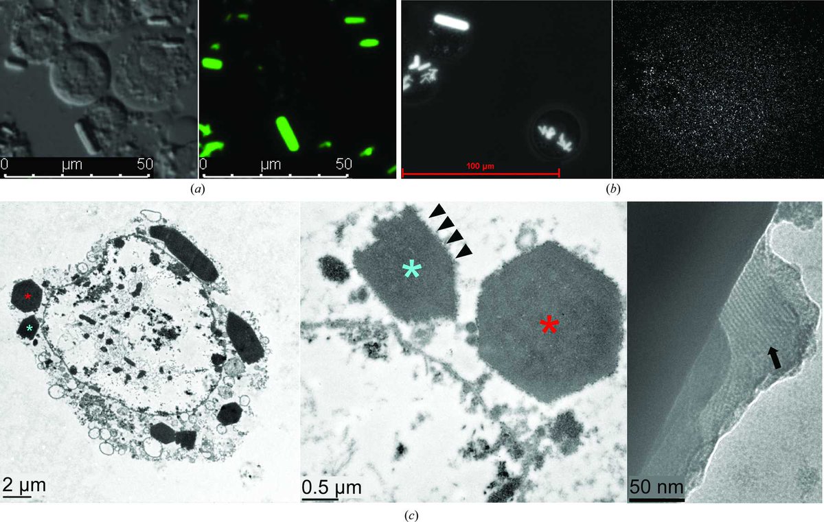 formulatrix's tweet photo. Acta Cryst: Enhanced X-ray diffraction of in vivo-grown ฮผNS crystals by viscous jets at XFELs
#crystallization #crystallography #sonicc
https://t.co/6mACOVzsf4 https://t.co/HCW9L2AmUW