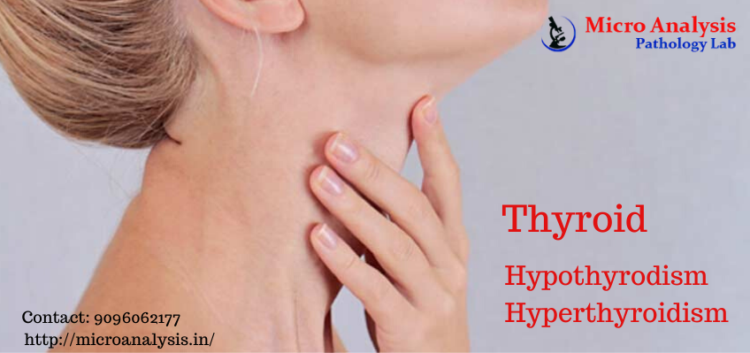 PahologyLab's tweet photo. Thyroid Profile
visit here:- https://t.co/JIuQuNHZyW
#thyroid #health #hypothyroidism #diabetes #thyroidhealth #thyroidhealing #thyroidproblems #weightloss #autoimmunedisease #hashimotos #healthylifestyle #thyroiddisease #hormones https://t.co/24lGuS0Jjr