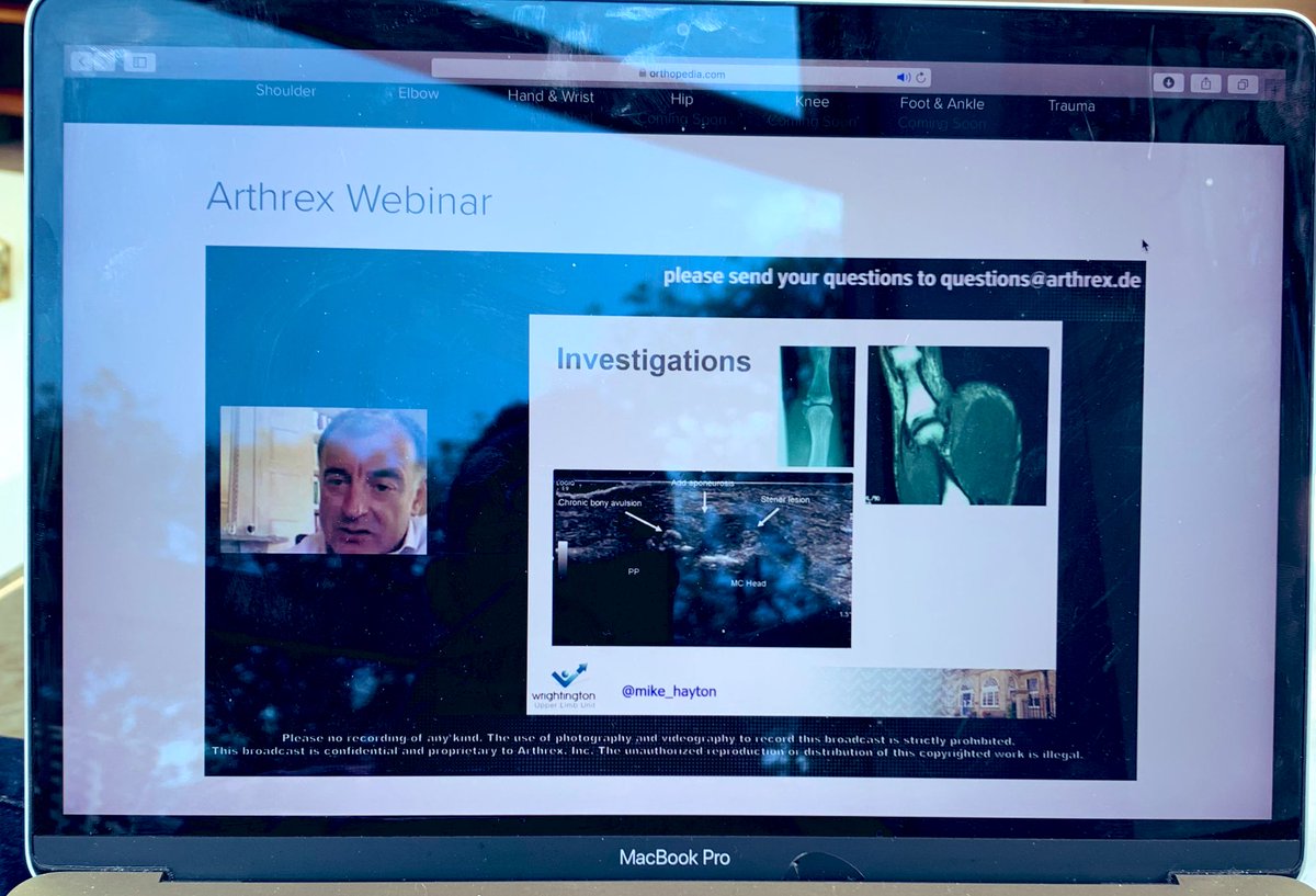 Mr David Murray (@ukhandsurgery) on Twitter photo Enjoying the <a href="/ArthrexMedEd/">Arthrex MedEd</a> webinar on thumb MCPJ injuries. One benefit of lockdown is the increase in educational material available! Thanks <a href="/mike_hayton/">Mike Hayton</a> for the excellent presentation Enjoying the <a href="/ArthrexMedEd/">Arthrex MedEd</a> webinar on thumb MCPJ injuries. One benefit of lockdown is the increase in educational material available! Thanks <a href="/mike_hayton/">Mike Hayton</a> for the excellent presentation