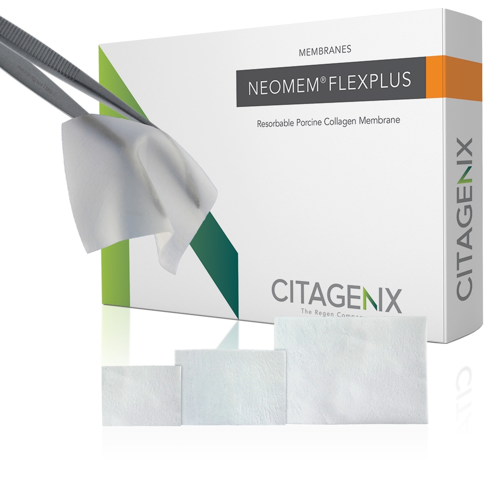 Citagenix's tweet image. Neomem FlexPlus is a single layer #collagenmembrane derived from porcine peritoneum. ✔ High suture pull out strength, excellent draping, lower inflammation, 3-4 month resorption &amp;amp; more! citagenix.com
#dentalimplants #dentistry #dentalER #oralsurgeon #oralsurgery #DDS