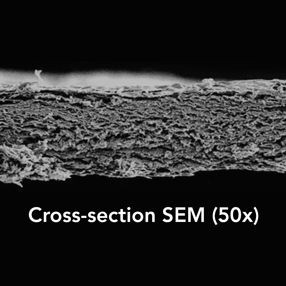 Citagenix's tweet image. Neomem FlexPlus is a single layer #collagenmembrane derived from porcine peritoneum. ✔ High suture pull out strength, excellent draping, lower inflammation, 3-4 month resorption &amp;amp; more! citagenix.com
#dentalimplants #dentistry #dentalER #oralsurgeon #oralsurgery #DDS