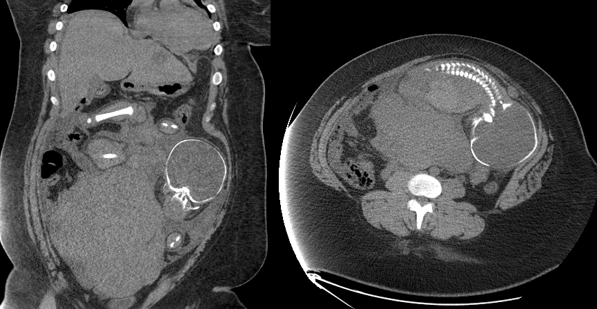 UAB Emergency Ultrasound tweet media
