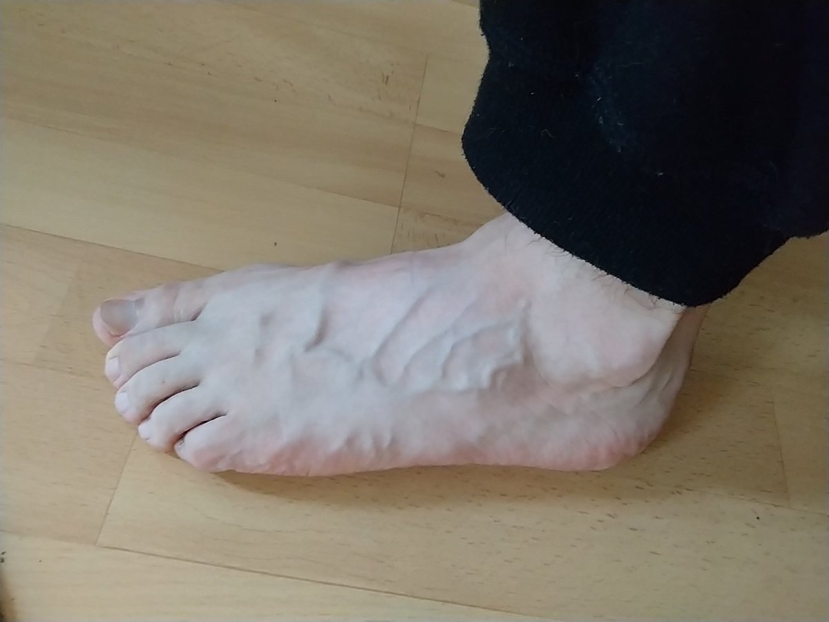 textoed's tweet image. Сетка вен на моей ноге после бега.