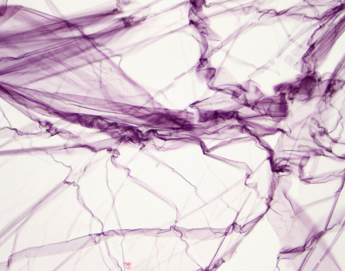 sarah_glogowski's tweet photo. Little bonus on the edge of a slide. #pathology #pathart #bumcpath https://t.co/50h8MO17bo