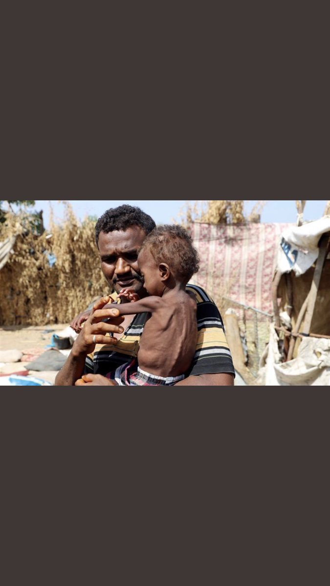 Yemen is suffering from the worst humanitarian crisis and too many of you are being SILENT. Please donate and raise awareness. I’m actually begging you