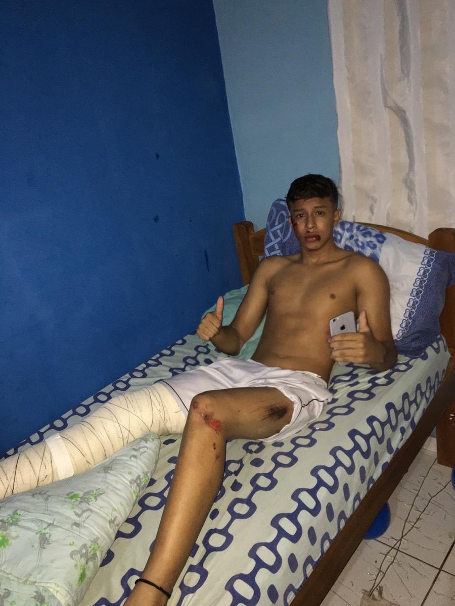 Jadsonn14's tweet photo. A vida é um grande contrato de risco tem curvas imprevisíveis e acidentes inevitáveis. E deus esteve comigo no momento certo❤️Meus 18 não teve festa, mas teve uma coisa melhor que isso, tive uma lição de vida🙏🏻 agredecer a deus todos os dias por me dar essa oportunidade de viver! https://t.co/66zCWL3MmV