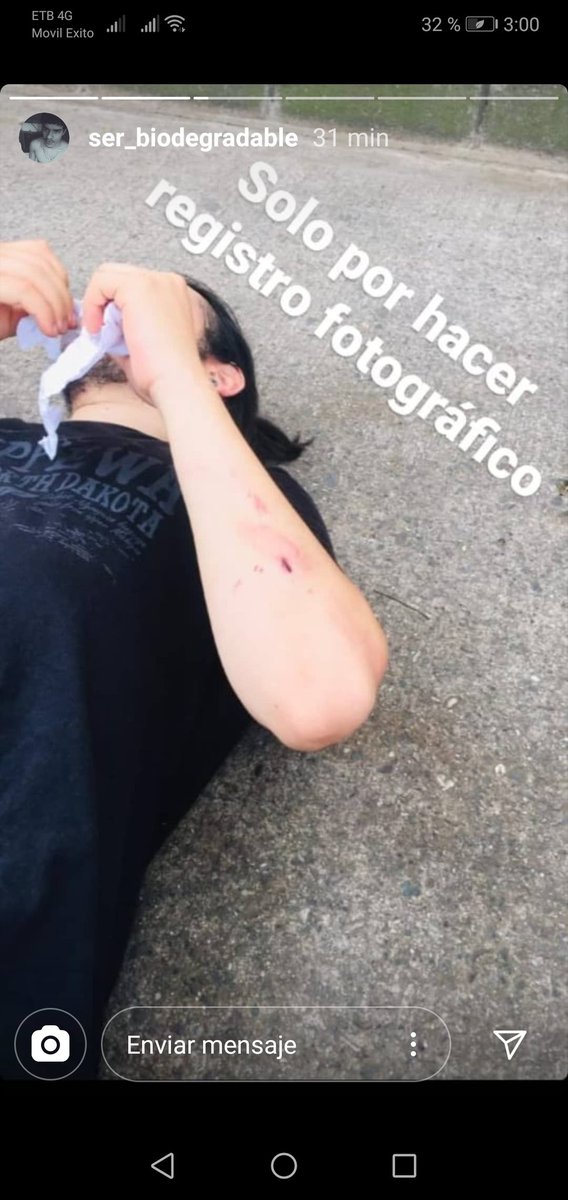 Santiag63720716's tweet photo. @QuinteroCalle @AlcaldiadeMed @estebanrestre las imágenes hablan por si solas y demuestran la #BrutalidadPolicialMedellin del ESMAD @PoliciaMedellin @PoliciaColombia en #Medellin el #15deJunio 
#QuinteroRepresor #QuinterosIrresponsable #QuinteroNoMeCuida #MedellinNoMeCuida https://t.co/75S8DAikRP
