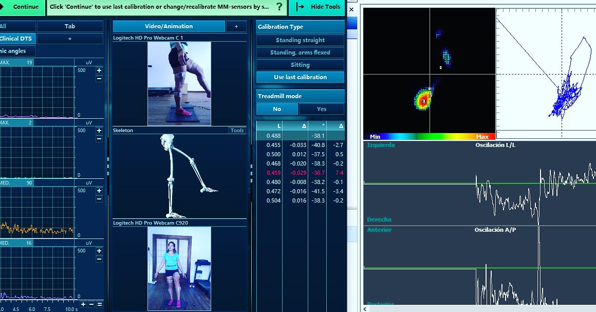 Kineticsports01's tweet photo. Evaluamos a una jugadora de #voleibol a los 7 meses de su pop lca de #rodilla 
Protocolo: evaluación Biomecánica 3d, emg, cámaras de video, baropodometria.
#noraxon #evaluaciones #analisisdevideo #electromiografía #myomotion3d #rehabilitación #atletas #kinesiología #freestep https://t.co/aJ0nAyzAld