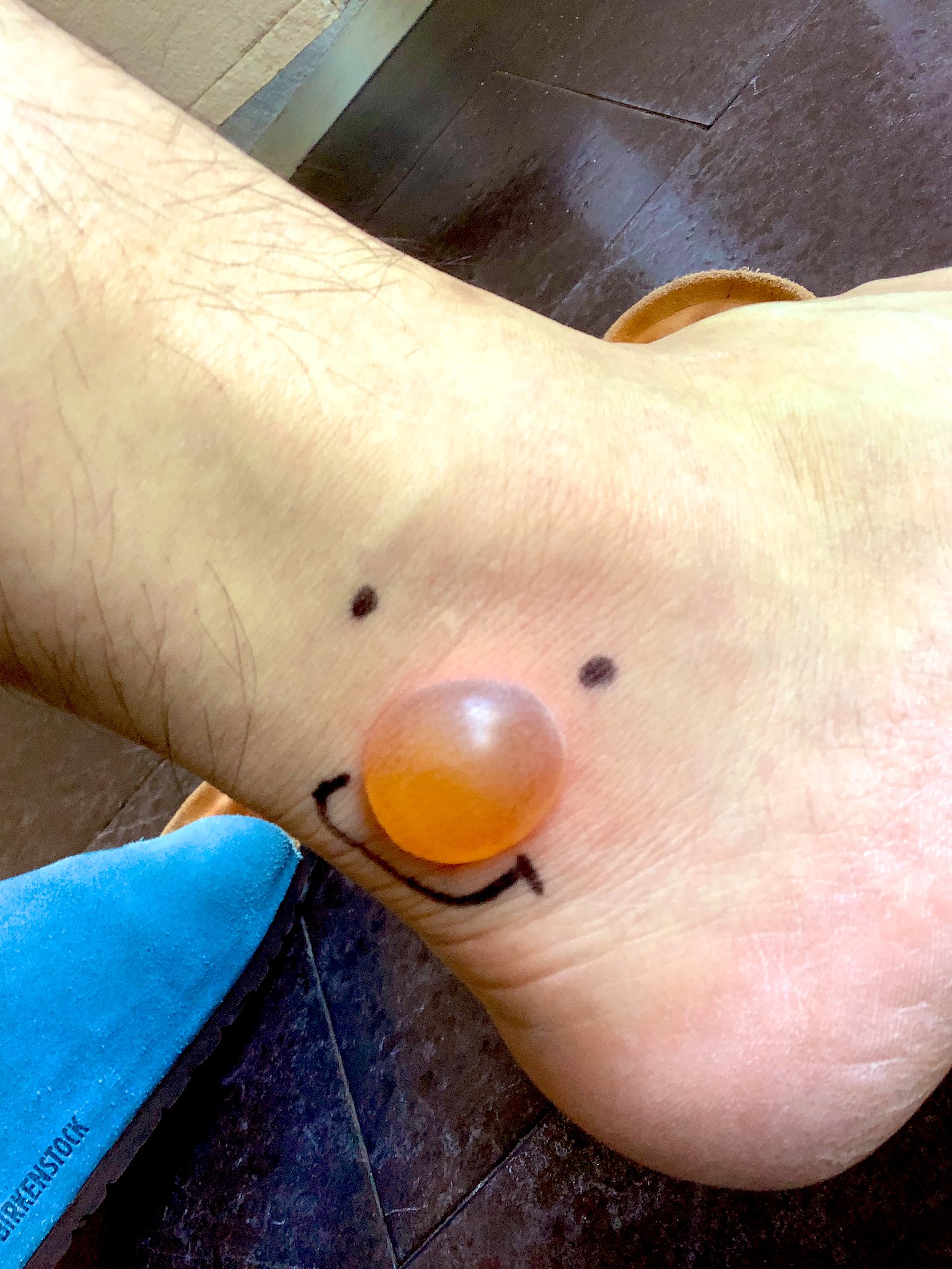 樋口太陽 ブヨに刺された腫れがさらに色が濃く 赤っぽくなりはじめました 東京アラートです 皮膚科に来ました どういう処置になるのか 追ってツイートいたします T Co I4jykz7wet Twitter