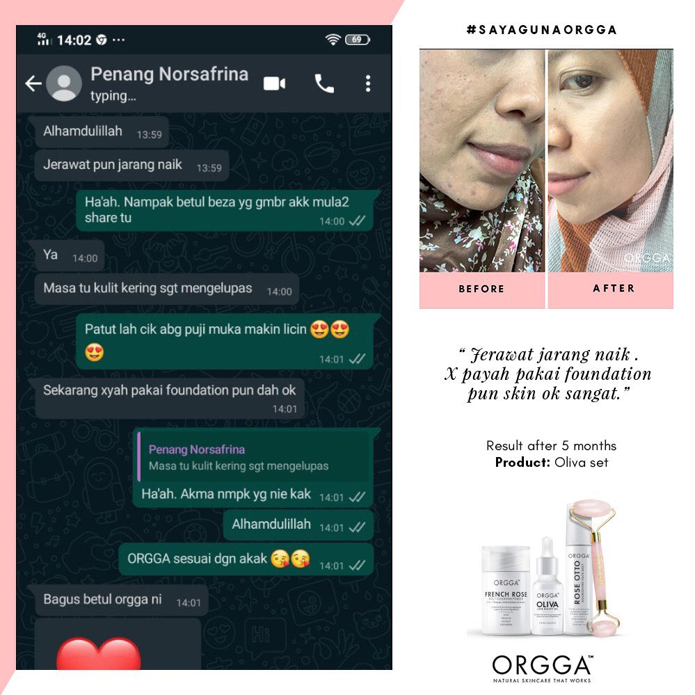 OrggaMalaysia's tweet photo. #OrggaFeedback | Honest review by Norsafrina from Penang, after using our Oliva Set [suitable for dry &amp; mature skin type] for 5 months , her skin getting better with Orgga Malaysia and FREE consultation from our Orgga Rangers @asyida_ ❤️ https://t.co/CBT3hg0uoo