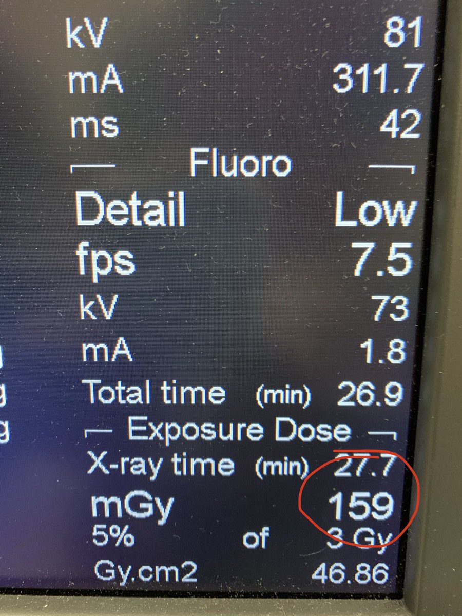 Ari Isaacson (@ariisaacsonmd) on Twitter photo Breaking new barriers for low dose PAE! 2 CBCTAs, great embo, 159 mGy! @GEHealthcare <a href="/clarelouisebent/">Clare</a> @marklittle_IR <a href="/keithppereira/">Keith Pereira MD, #VIrad</a> <a href="/SandeepBaglaMD/">Sandeep Bagla MD</a> <a href="/SamMouli/">Sam Mouli</a> <a href="/IR_Nutt/">Charles Nutting, DO FSIR</a> @JeremyKimMD <a href="/nunovpc/">Nuno Vasco Costa</a> <a href="/bonesz/">Aaron Fischman MD | Interventional Radiologist</a> <a href="/BDixonMD/">Bob Dixon</a> <a href="/TimMcClureMD/">Tim McClure</a> Breaking new barriers for low dose PAE! 2 CBCTAs, great embo, 159 mGy! @GEHealthcare <a href="/clarelouisebent/">Clare</a> @marklittle_IR <a href="/keithppereira/">Keith Pereira MD, #VIrad</a> <a href="/SandeepBaglaMD/">Sandeep Bagla MD</a> <a href="/SamMouli/">Sam Mouli</a> <a href="/IR_Nutt/">Charles Nutting, DO FSIR</a> @JeremyKimMD <a href="/nunovpc/">Nuno Vasco Costa</a> <a href="/bonesz/">Aaron Fischman MD | Interventional Radiologist</a> <a href="/BDixonMD/">Bob Dixon</a> <a href="/TimMcClureMD/">Tim McClure</a>