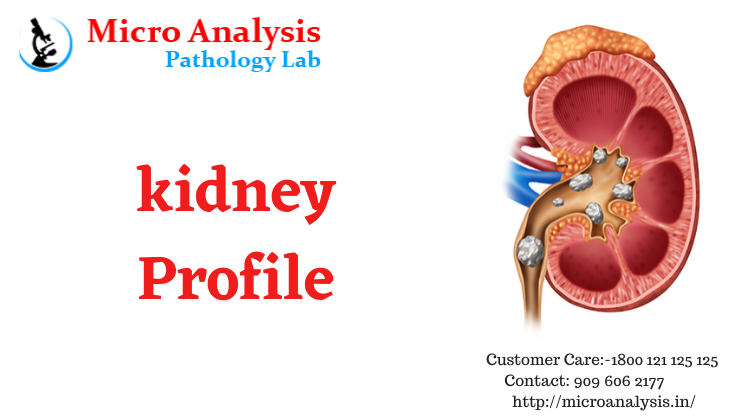 PahologyLab's tweet photo. Kidneys 
visit here:- https://t.co/JIuQuNHZyW
#kidney #kidneydisease #kidneytransplant #kidneyhealth #health #kidneyfailure #nephrology #medicine #dialysis #ckd #kidneys #kidneystones #transplant #renal #medical #kidneycancer #worldkidneyday #chronickidneydisease #urology https://t.co/aTky548tCO