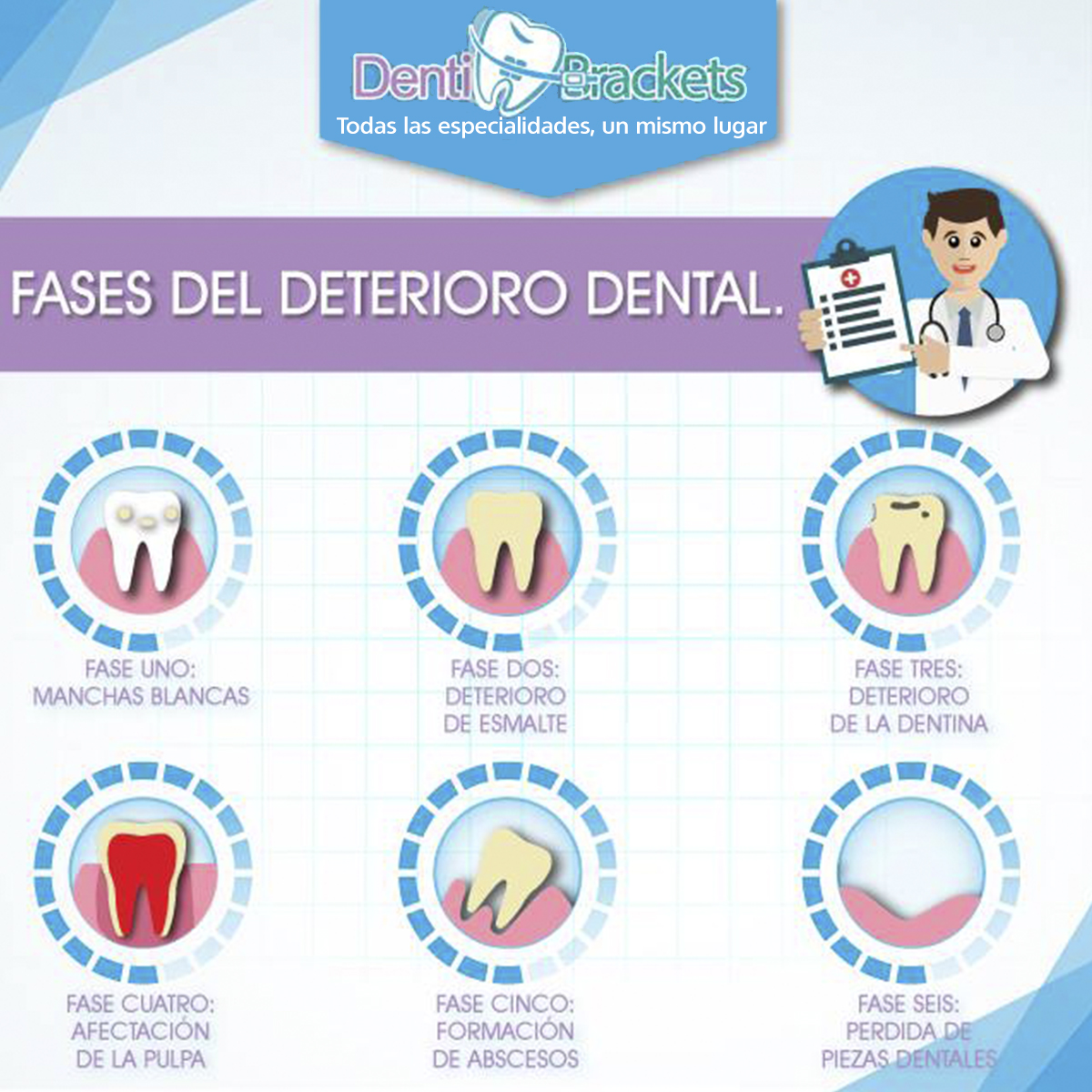 DentibracketsM's tweet photo. Conoce las etapas del #deteriorodental. Recuerda que en DENTIBRACKETS nos gusta verte sonreír 😁 Así que no esperes más y agenda tu cita hoy mismo para un atención de primera. Ven y vive la experiencia DENTIBRACKETS #todaslasespecialidadesunmismolugar 
#odontologia https://t.co/woxSSszx7A