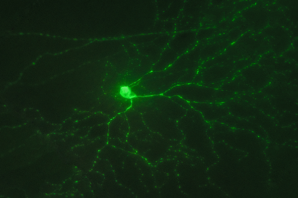 Rupanya, penurunan jumlah berkas cahaya yang masuk ke dalam mata tidak hanya disadari oleh dua jenis sel tadi. Ini dia si ganglion fotosensitif retina yang ruangannya ga jauh dari tempat si batang dan kerucut bekerja. Apa lagi itu ganglion fotosensitif?