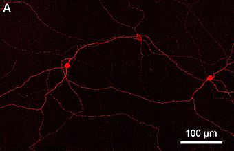 Rupanya, penurunan jumlah berkas cahaya yang masuk ke dalam mata tidak hanya disadari oleh dua jenis sel tadi. Ini dia si ganglion fotosensitif retina yang ruangannya ga jauh dari tempat si batang dan kerucut bekerja. Apa lagi itu ganglion fotosensitif?