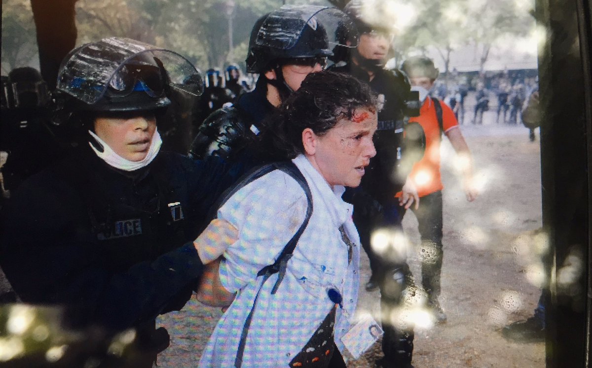 LouisWitter's tweet photo. Une soignante violemment arrêtée lors de la manif aux Invalides, ouverte à la tête pendant son interpellation, un policier appuyait dessus avec son genou. Ils l’ont embarquée par les cheveux. https://t.co/Wq5PU2KA46