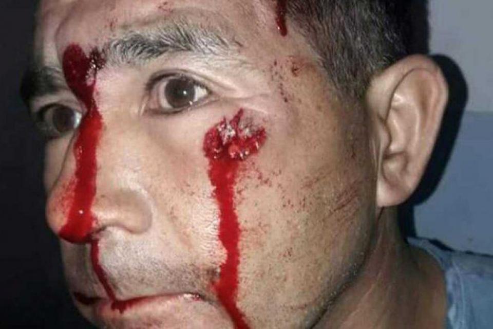 Continúa la violencia institucional en Chubut, en medio de la pandemia. El ministro de Seguridad, Federico Massoni, repite las prácticas que ya fueron cuestionadas por la Secretaría de Derechos Humanos de la Nación. Una nota de <a href="/adrianameyerok/">Adriana Meyer</a> | cadenadelsur.com/continua-la-vi…