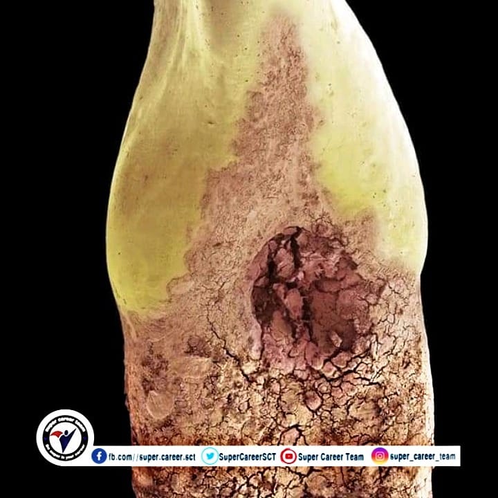 SuperCareerSCT's tweet photo. ما تبدوا عليه الأسنان عن قرب تحت المجهر الإلكتروني 🦷😲
What the teeth looked like under the electron microscope.
#be_Super #SCT
#microscop https://t.co/OAP6x3Iszl