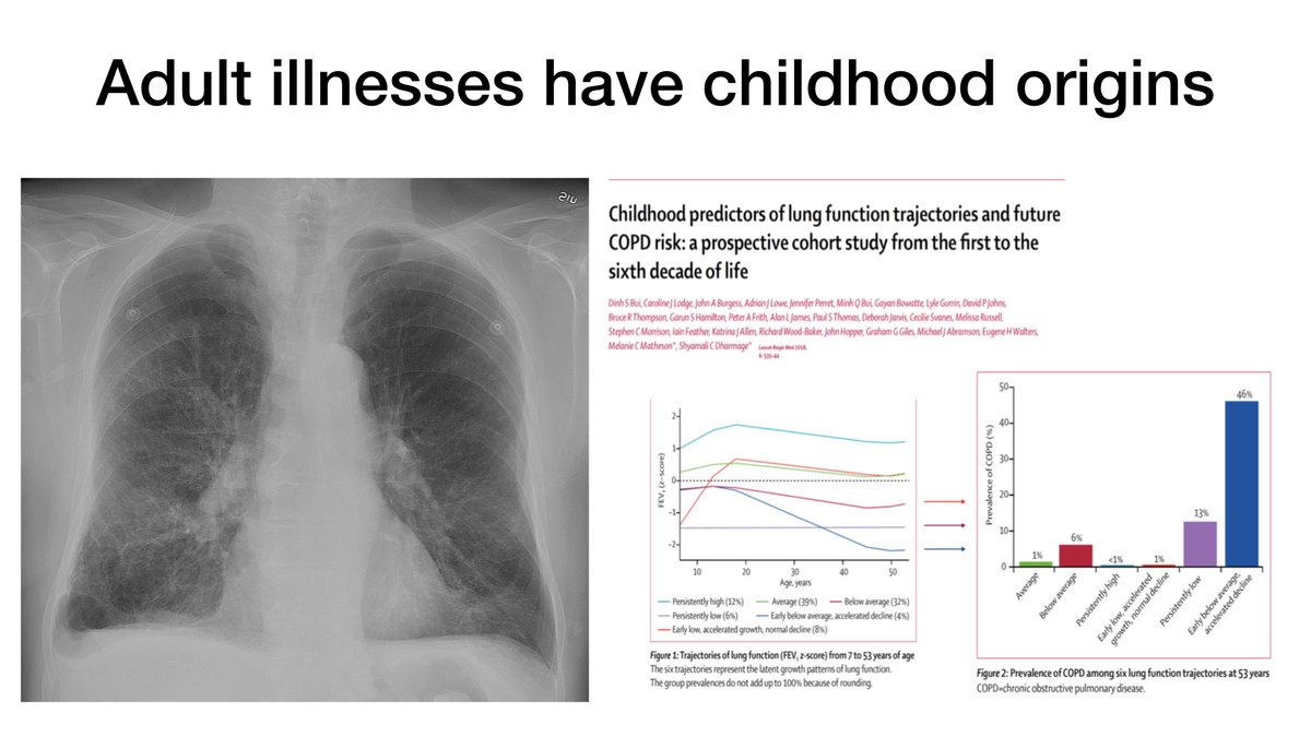 And these inequalities are traced to childhood. We always thought COPD was a disease of accelerated lung decline... actually for many people it reflects adverse exposures in childhood - ie your health (in  @ProfHurst's COPD clinic is programmed in @omi_narayans paeds clinic