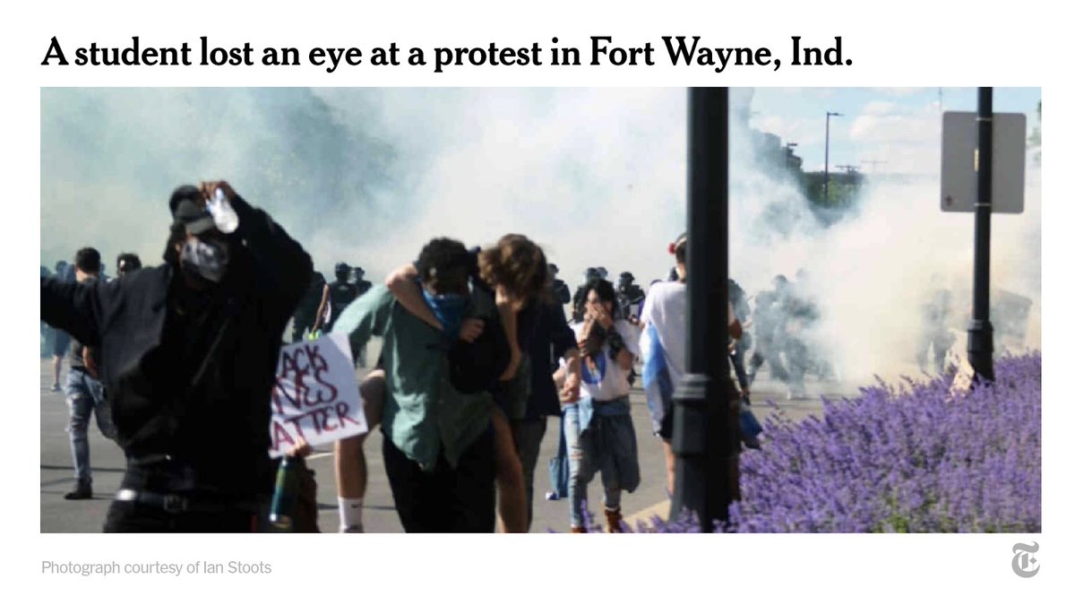 Misuse of tear gas can cause debilitating injuries, like permanent vision damage, asthma and other long-term injuries.A 21-year-old student protesting in Fort Wayne, Indiana, lost an eye after being hit by a tear gas canister.  http://nyti.ms/37B2oFO&nbsp;