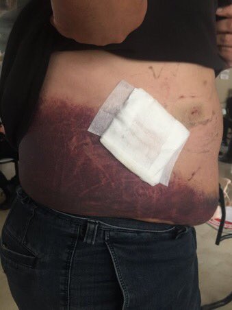 Adana da Eşi içerde olan insanlara yardım ettiği için Özel Haraket polisi ile operasyon yapılan  Mustafa Erhan Çetinus bu haliyle tutuklanmış😢

Geceleri rahat uyuyabiliyormusun?<a href="/abdulhamitgul/">Abdulhamit Gül</a> 

Bu zulme bir lafınız varmı <a href="/alibabacan/">Ali Babacan</a> <a href="/Ahmet_Davutoglu/">Ahmet Davutoğlu</a> 

SıttıkaNineyi SokağaAtmayın