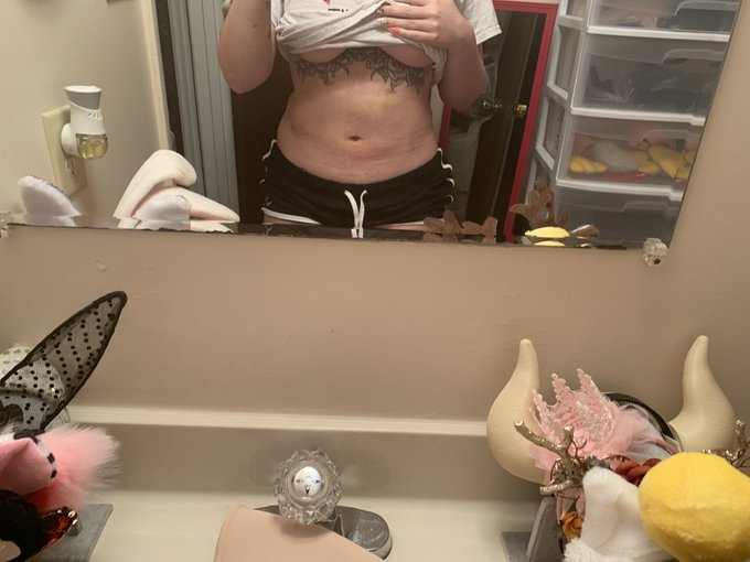 1 pic. Wasn’t gonna post this up cuz I’m still super swollen and bruised but here is a week after getting