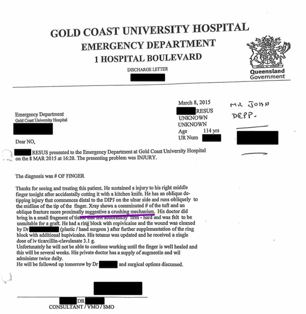 Despite the court order to produce all the medical records of his finger's injury, Depp has failed to produce it. Including the medical record his youtube-minion spread around & show us the exact reason why he's hiding the records: It proves it was a CRUSHING INJURY 