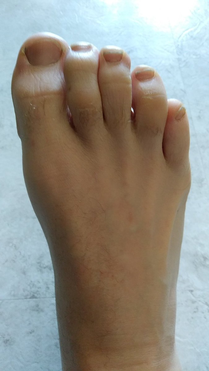 findomredneck's tweet photo. Who wants these toes in their mouth! Daddy needs a TJ now! Where are my foot worshipers?
#alphapits #findom #cashslaves 
 #footfetish #alpha #paypigs  #cashmaster  @MASTER_UPDATES  @FindomShawnRT @rt4dom https://t.co/1Ob113q6Xm