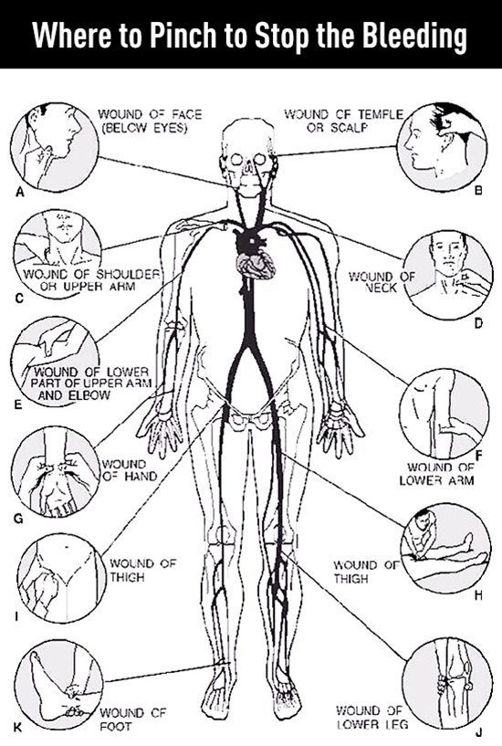 Where to pinch to stop bleeding
#SHFT #prepper #preppers #preparedness #FirstAid #survival #apocalypse2020