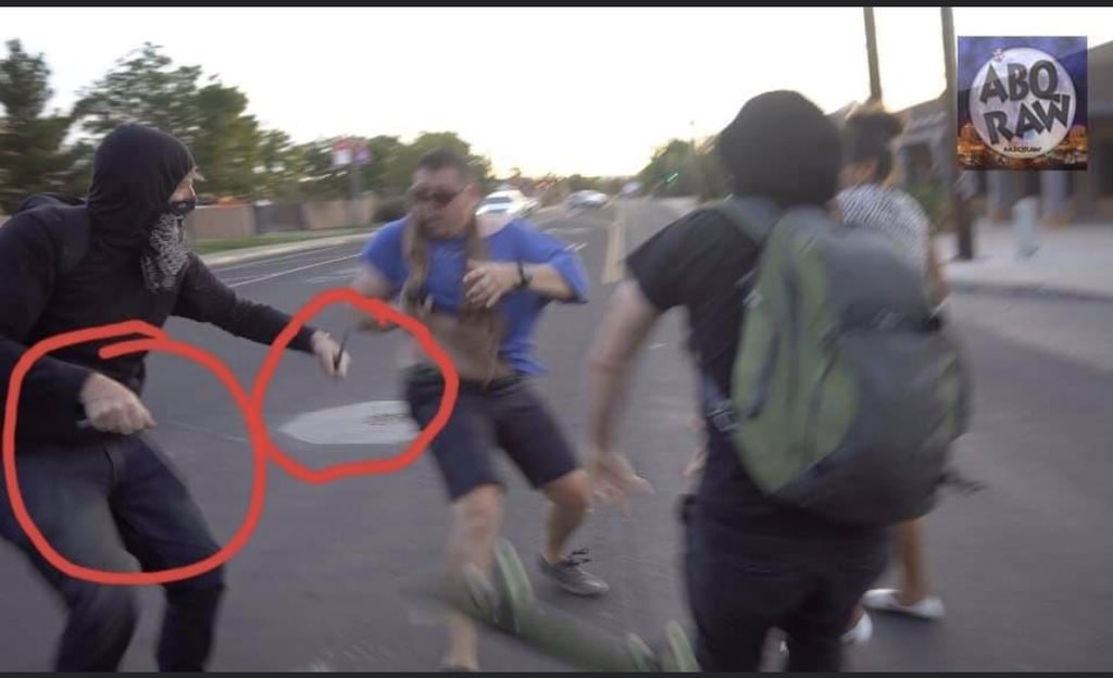 carlsbadbugkil1's tweet photo. @robbrow @ABQJournal GTFOH 🖕🏾did u miss the part where he was attacked by several ppl shouting they were gonna kill him &amp; having the means to do it?! That skateboard &amp; what appears to be a knife arent party favors dumbass.... #JournalismIsDead #Vendidos #Liars #FakeNews #NBCisTRASH #BASURA https://t.co/vSwOaj23nH